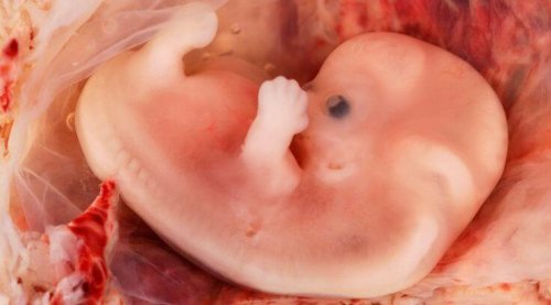 Entwicklung des Babys - Dritter Monat