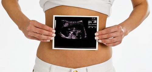 Schwangerschaft Woche für Woche - Ultraschall