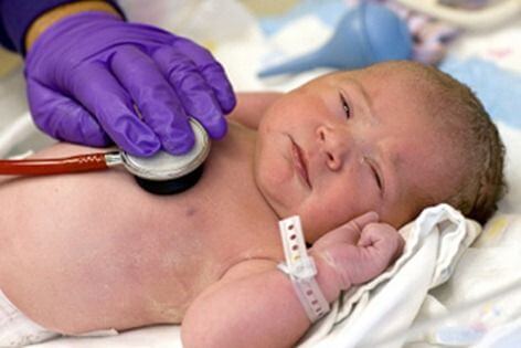 der Apgar-Test - Baby beim Arzt