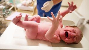 Was ist der Apgar-Test und warum ist er so wichtig?