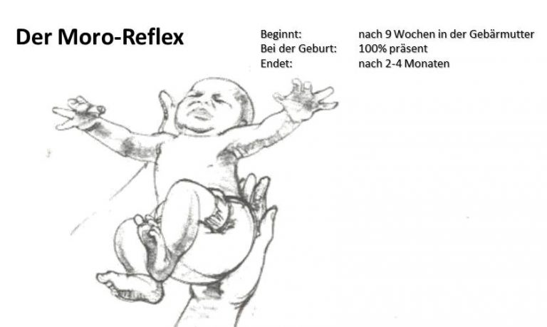 Moro Reflex Geht Nicht Weg ichbinmutter.com