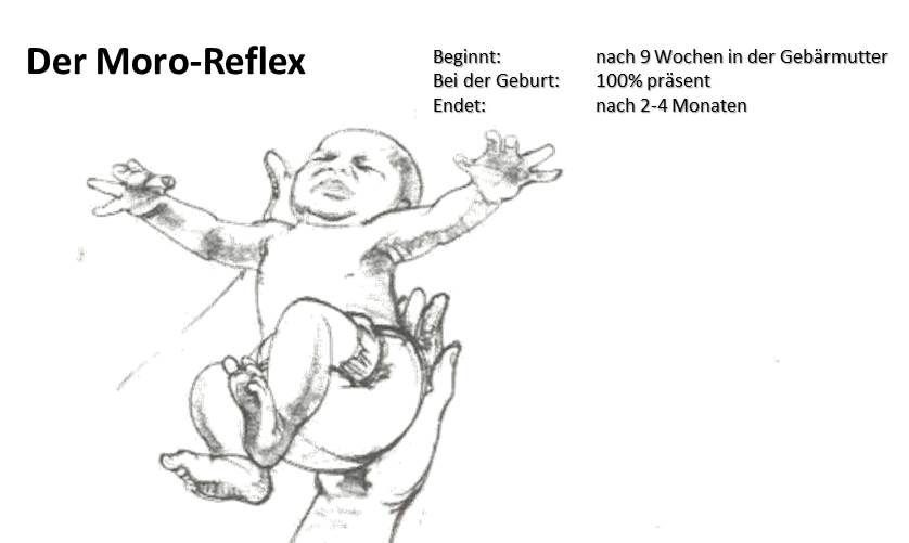 Der Moro-Reflex - Details