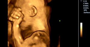 Was dein Baby fühlt, wenn du während der Schwangerschaft aus Traurigkeit weinst