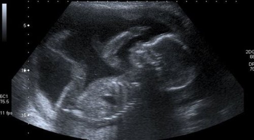 Ab dem Spüren der ersten Kindsbewegungen beginnt eine ganz besonders innige Liebe.