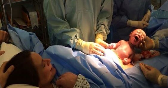 Einfacher Kaiserschnitt Operation