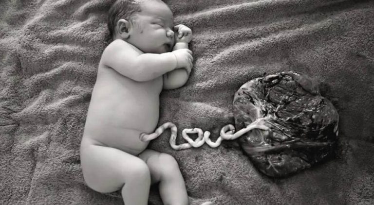 Spende von Nabelschnurblut