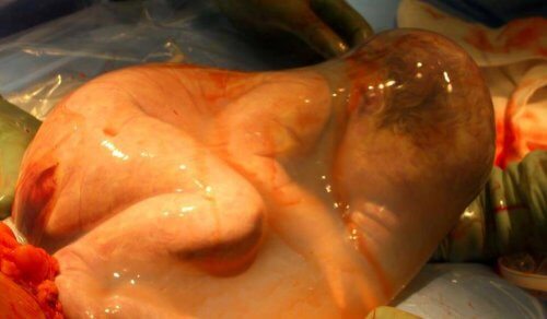 Die Geburt mit Glückshaube wird oft als mysteriös gesehen