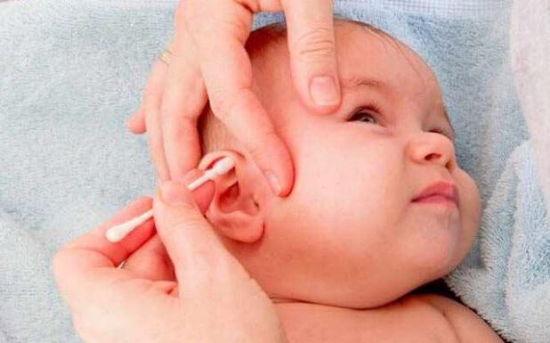 Ohrinfektionen bei Babys können durch Vorsichtsmaßnahmen eingedämmt werden