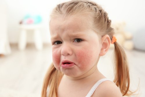Die häufigsten Nahrungsmittelallergien bei Kindern