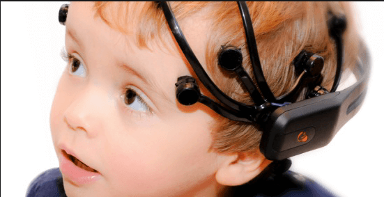 Elektroenzephalografie ist eine Behandlungsart von Absenzanfällen.