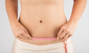 Die Narbenpflege nach einem Kaiserschnitt