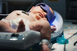 Alles über Neugeborenengelbsucht bei Säuglingen