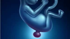 Babys, die mit Spina bifida geboren wurden