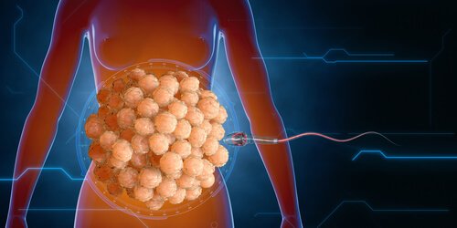 Die ersten Hindernisse für die Spermien