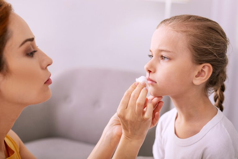 Nasenbluten bei Kindern richtig behandeln und vermeiden