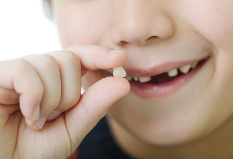Der Zahnwechsel bei Kindern - in welcher Reihenfolge verläuft er? - Ich