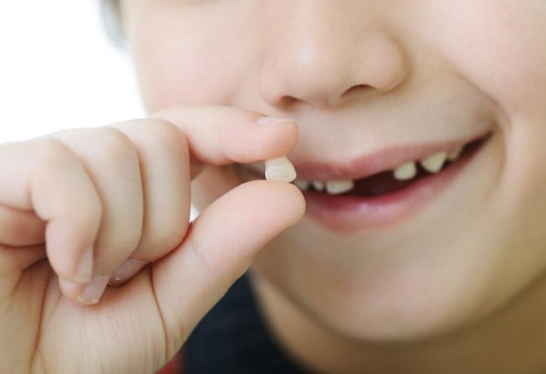 Der Zahnwechsel bei Kindern - in welcher Reihenfolge verläuft er?