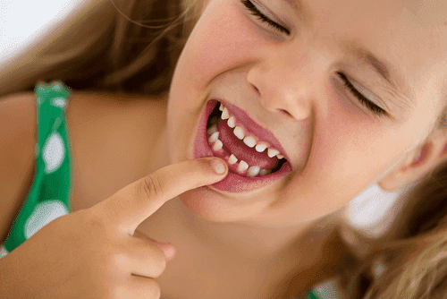 Der Zahnwechsel bei Kindern dauert etwa 3 Jahre.