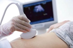 Was ist das Amniotische-Band-Syndrom?