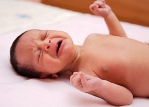 Schiefhals bei Babys