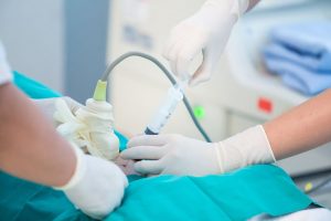 Was du über die Fruchtwasseruntersuchung wissen solltest