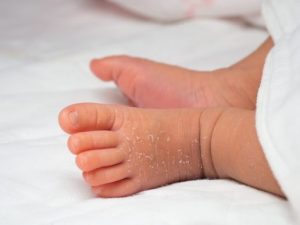 So pflegst du die Haut von Neugeborenen