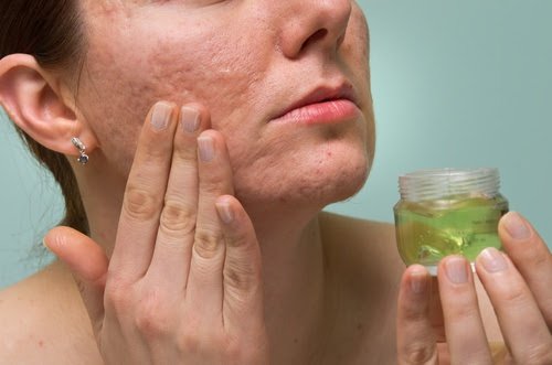 Narben mit Aloe Vera Gel behandeln
