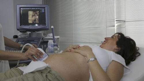 Schwangere blickt auf Ultraschallbild