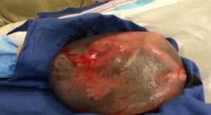 Kind mit intakter Fruchtblase