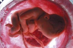 Nabelschnurverwicklung bei Baby im Bauch