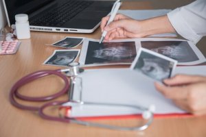 Fetaler Distress: 7 Anzeichen