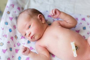 6 häufige Fehler bei der Nabelpflege