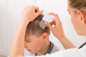 4 Heilmittel gegen Schuppenflechte