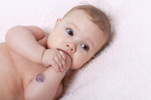 Häufige kraniofaziale Fehlbildungen bei Babys