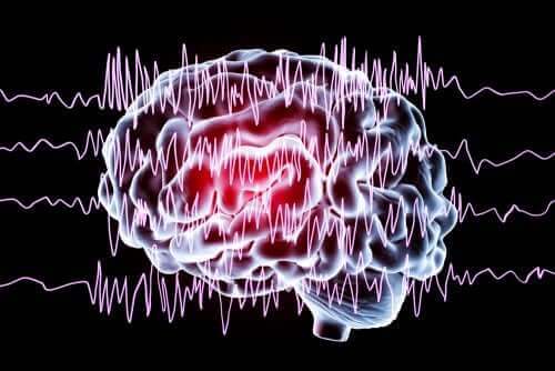 Nicht-epileptische paroxysmale Ereignisse bei Kindern