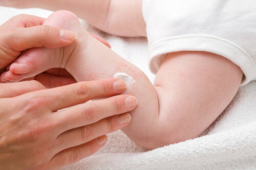 Trockene Haut bei Babys: 10 natürliche Heilmittel