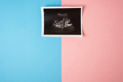Das Geschlecht deines Babys beim ersten Ultraschall erfahren: Ist das möglich?