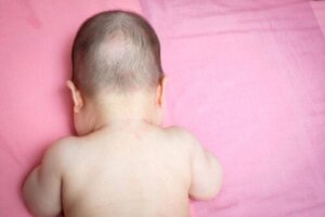 Warum hat mein Baby kahle Stellen?
