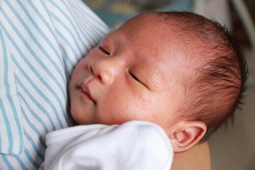 Milchallergie bei Säuglingen: Was du wissen solltest