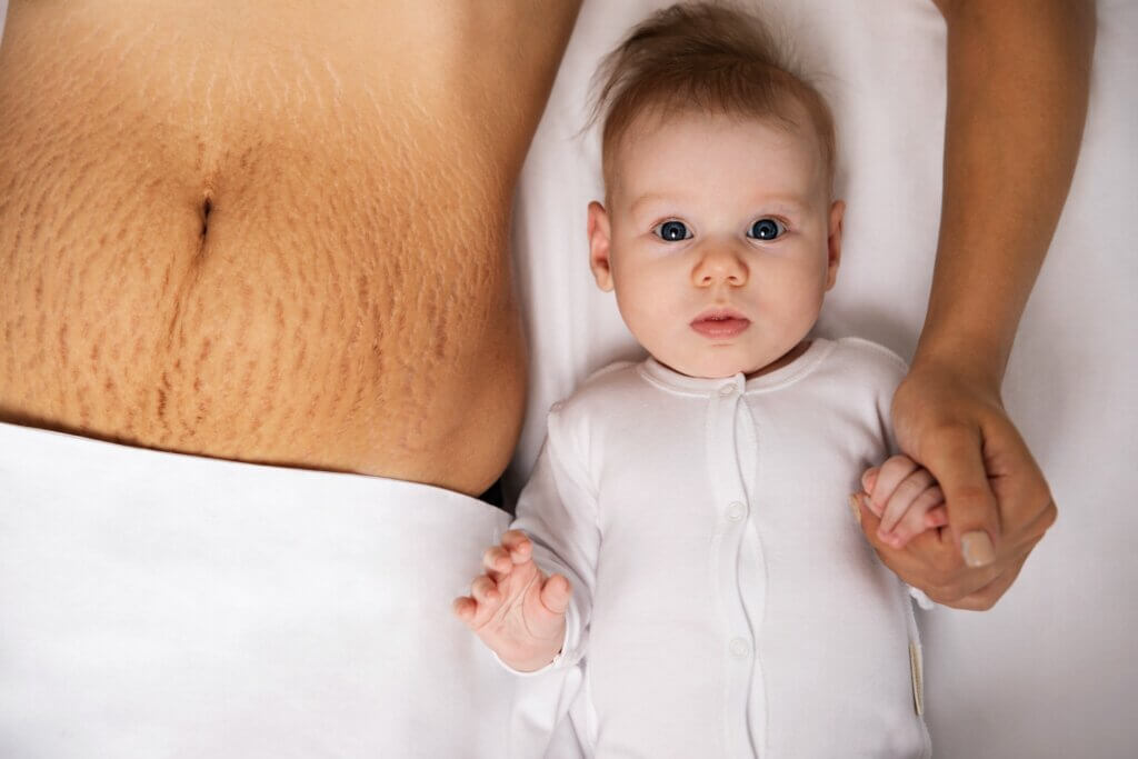 After-Baby-Body: Der Körper nach der Schwangerschaft