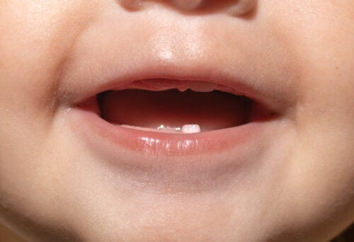 Der erste Zahnarztbesuch deines Kindes: Was dich erwartet